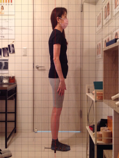 背骨×骨盤整復矯による施術効果