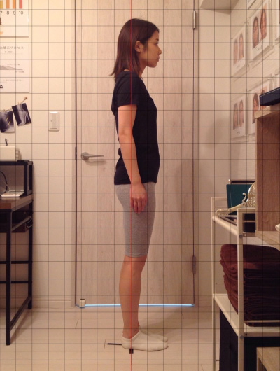 背骨×骨盤整復矯による施術効果