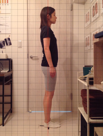 背骨×骨盤整復矯による施術効果