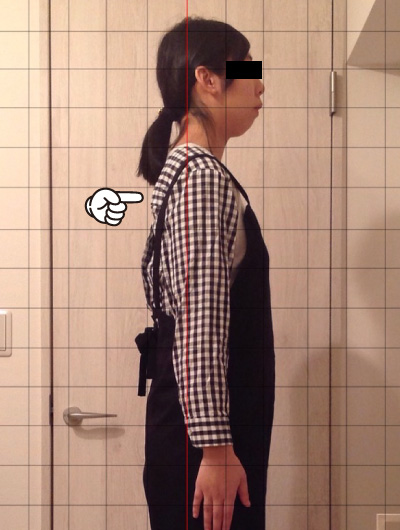 美骨整復術による改善例