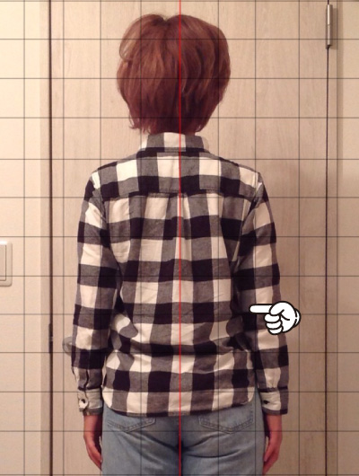 美骨整復術による改善例