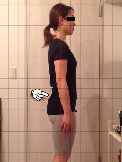 美骨整復術による改善例