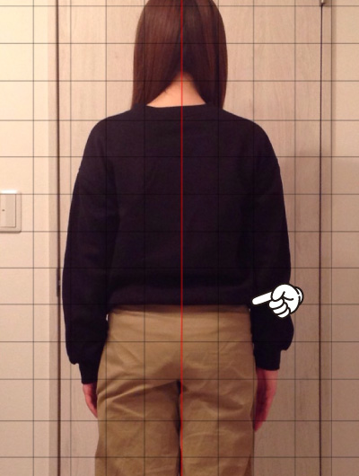 美骨整復術による改善例