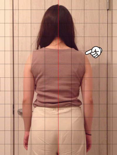 美骨整復術による改善例