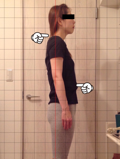 美骨整復術による改善例