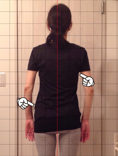 美骨整復術による改善例