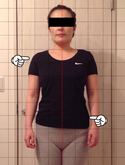 美骨整復術による改善例