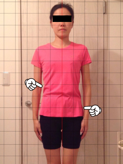 美骨整復術による改善例