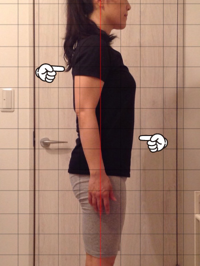 美骨整復術による改善例