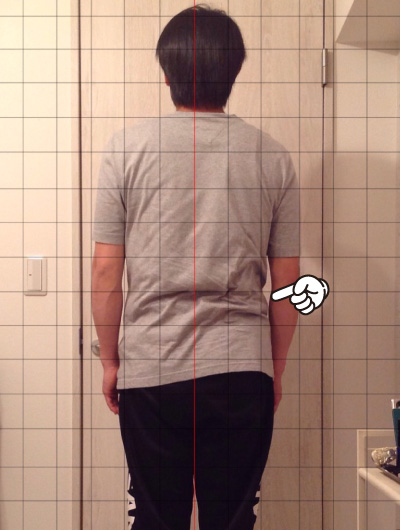 美骨整復術による改善例