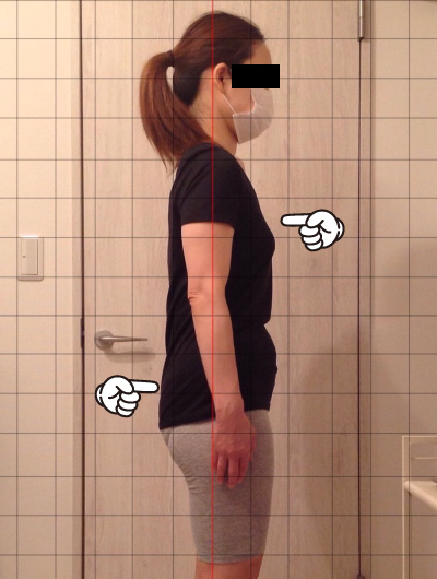 美骨整復術による改善例