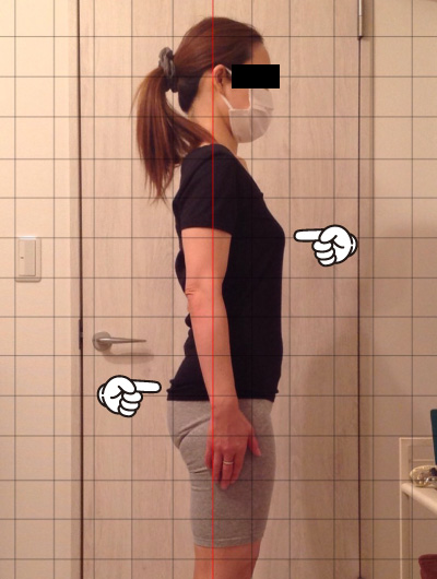 美骨整復術による改善例