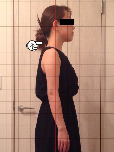 美骨整復術による改善例