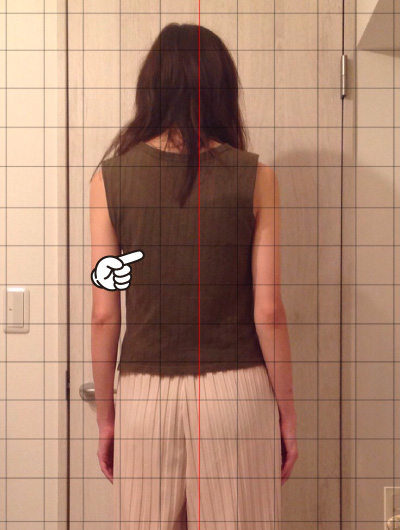 美骨整復術による改善例