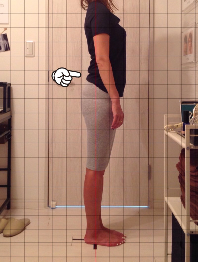 美骨整復術による改善例