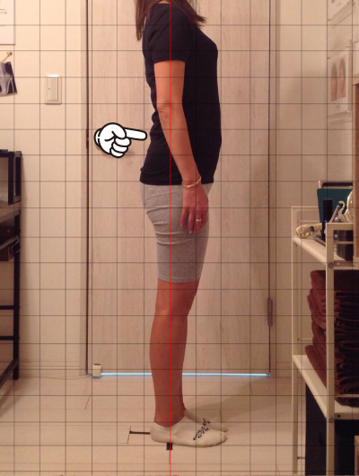 美骨整復術による改善例