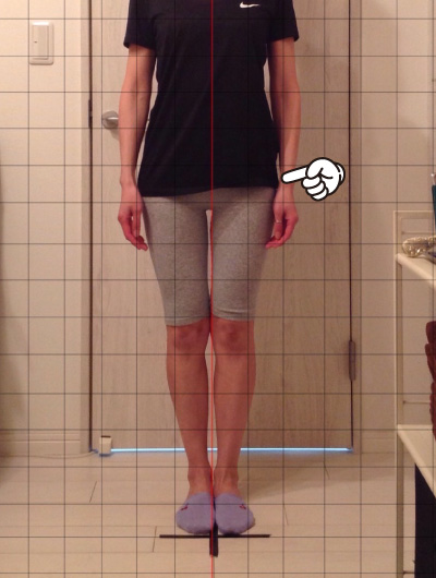 美骨整復術による改善例